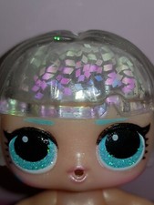 LOL SURPRISE GLITTER GLOBE -